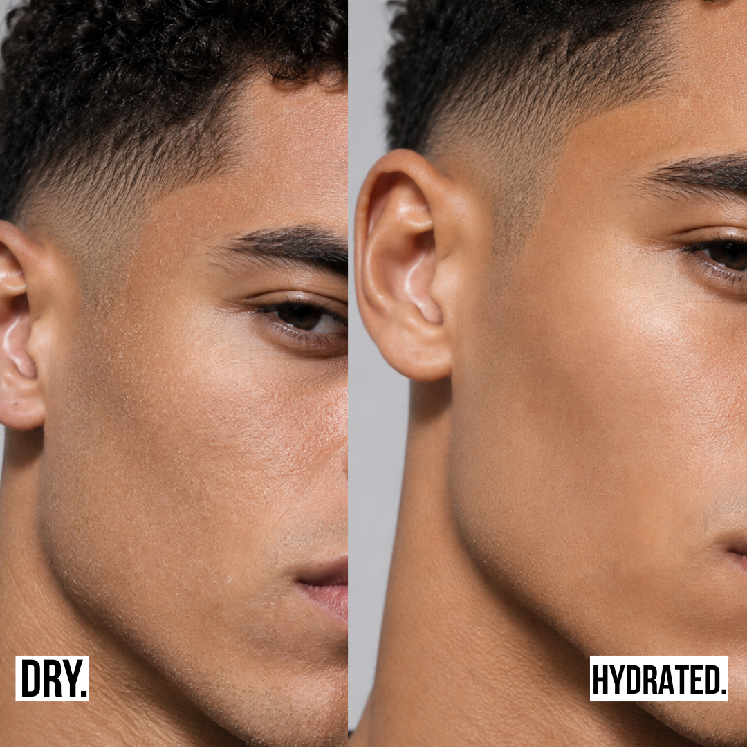 MOISTURE GEL