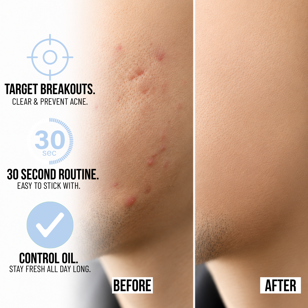 FACE GEL