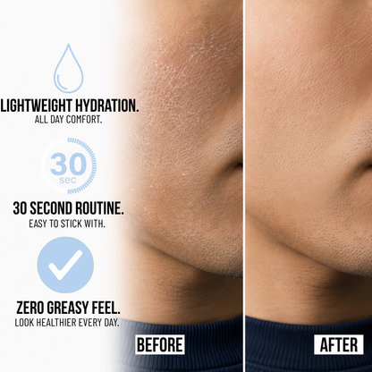 MOISTURE GEL